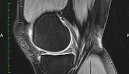 Operative Therapie 4